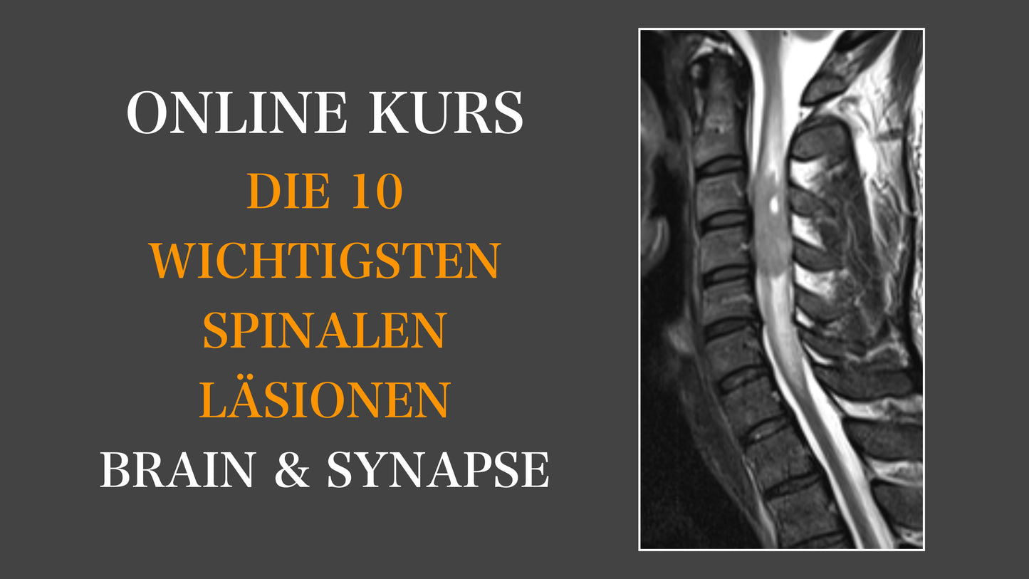 Die 10 Wichtigsten Spinalen Läsionen