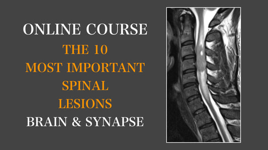The 10 Most Important Spinal Lesions (English Version)