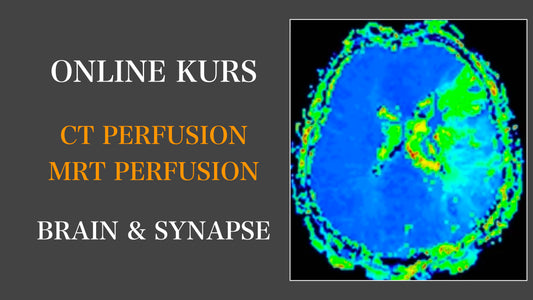 CT und MRT Perfusion des Hirnparenchyms (Deutsche Version)